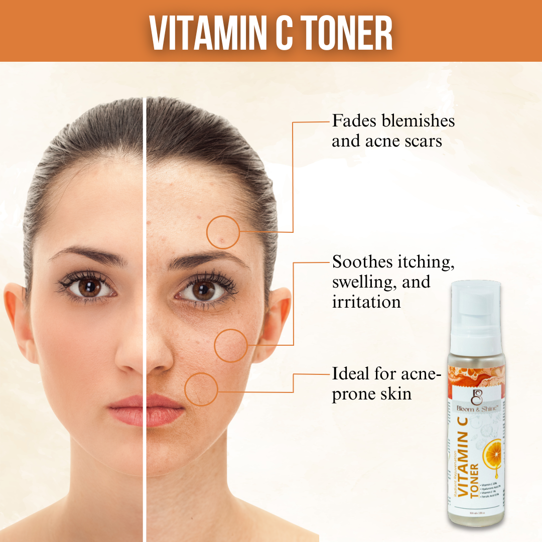 Vitamin C Face Toner Alcohol-Free with Aloe Vera, Cucumber, Green Tea & Rice Water – 100 ml